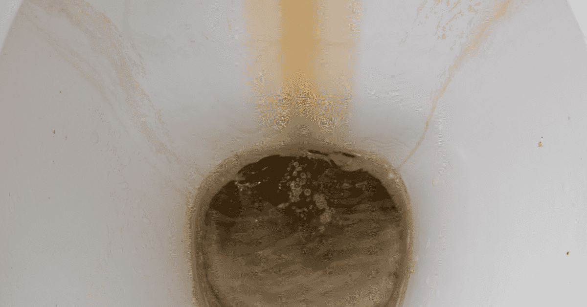 Rust In The Toilet Bowl? (Here’s How To Remove It!)